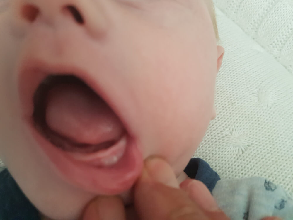 Krijgt onze baby vroeg tandjes?